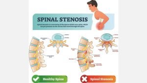 InCollage_20230506_200142018