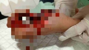 IMG_20250608_070838_U3cBCMfE5s